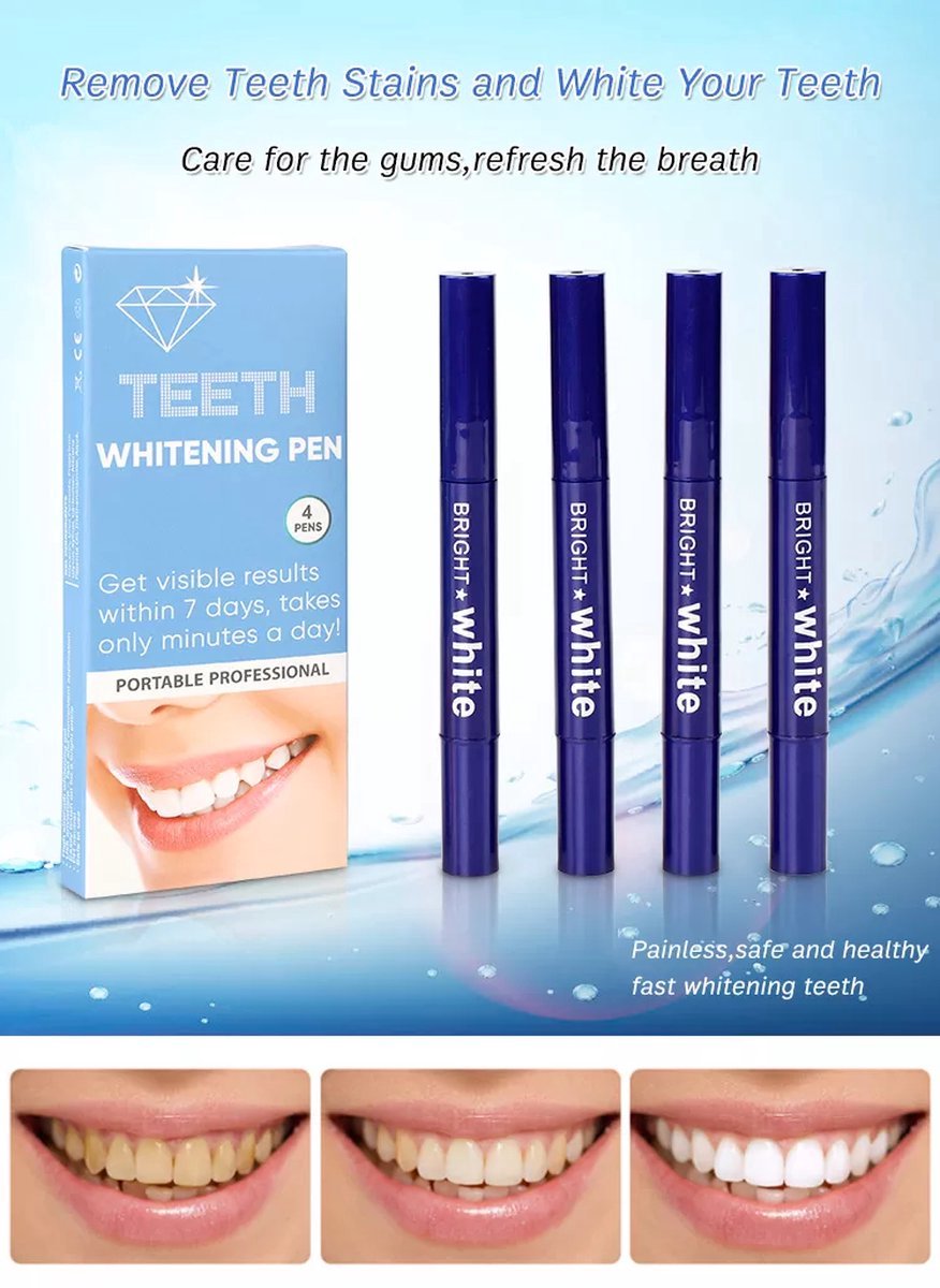 Teeth Whitening Pen | Tanden bleken pen | Witte tanden | 4 stuks